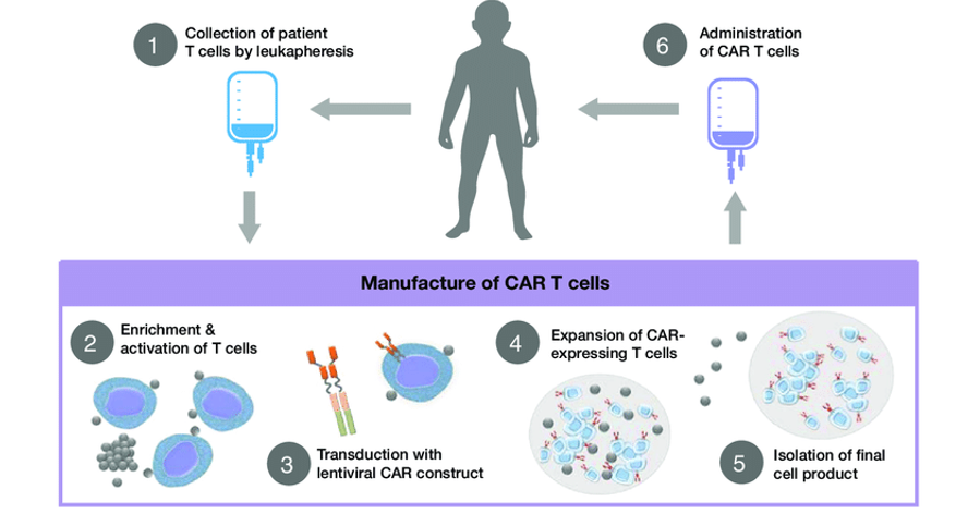 CAR-T principles